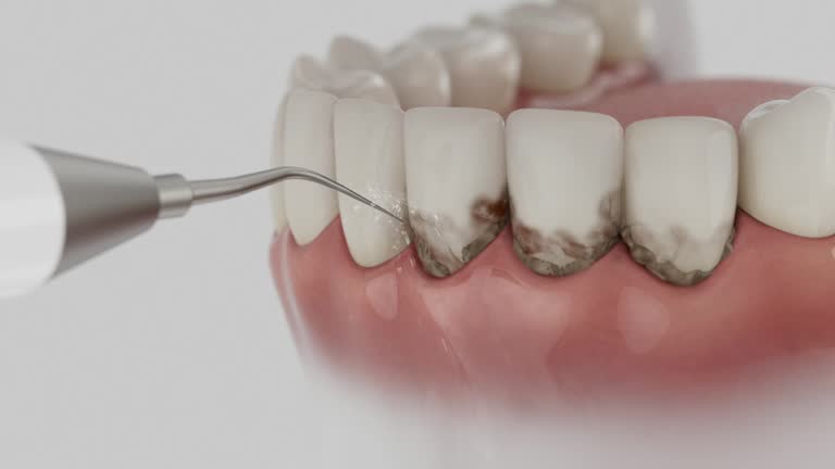 Reliable Dental Implants contractor in Osakis, MN by Smile Center Dentistry